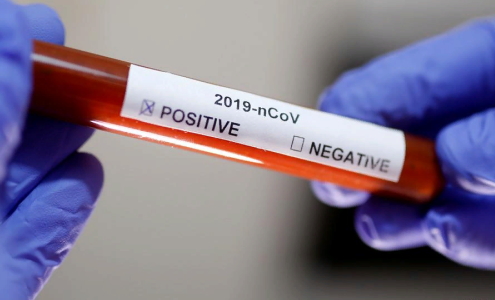 Коронавирус COVID-19